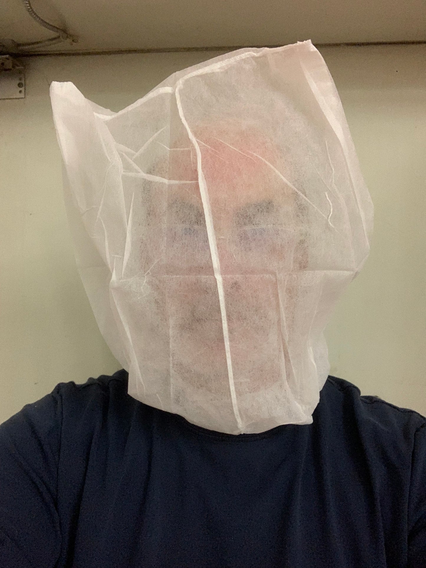 Spit Hood - Pack of 25